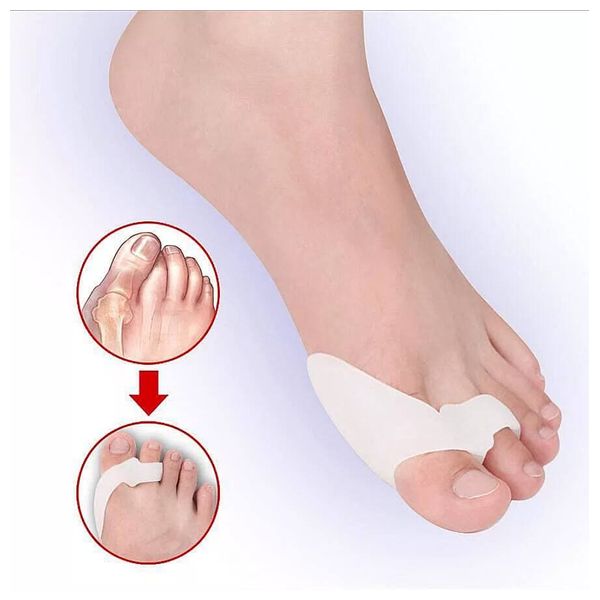  Silicone Toe Corrector - White 